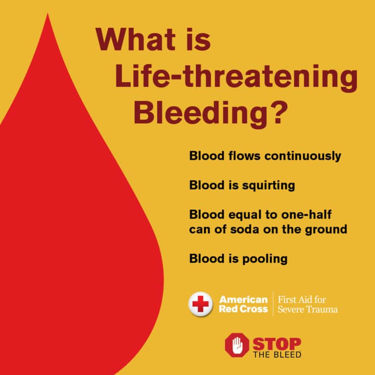 what-are-the-different-types-of-bleeding-in-first-aid